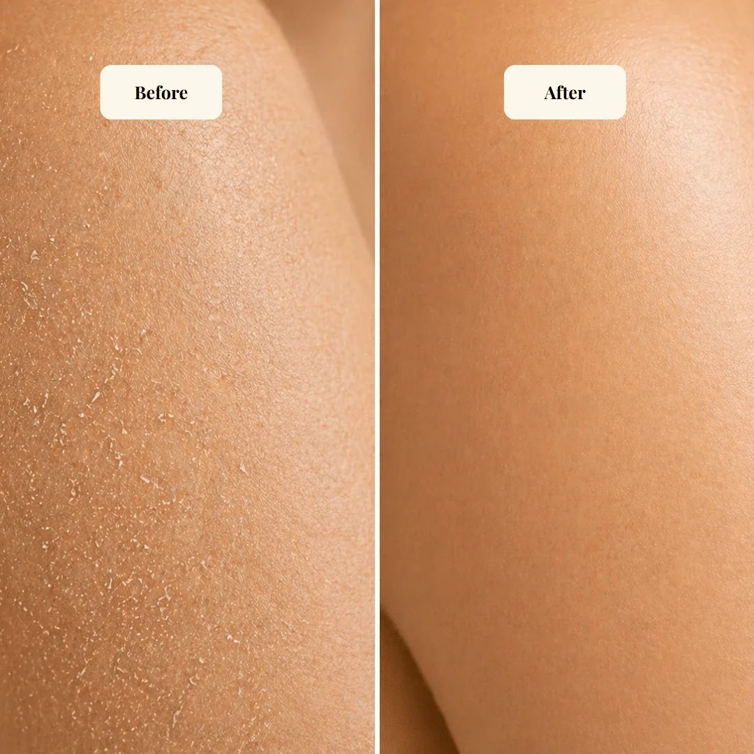 Nourishing Body Butter for Sensitive Skin-3