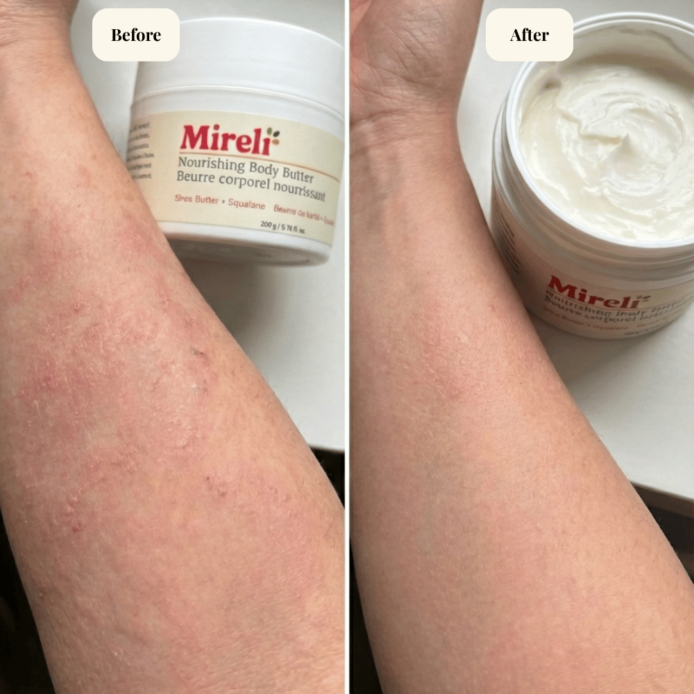 Nourishing Body Butter for Sensitive Skin-1