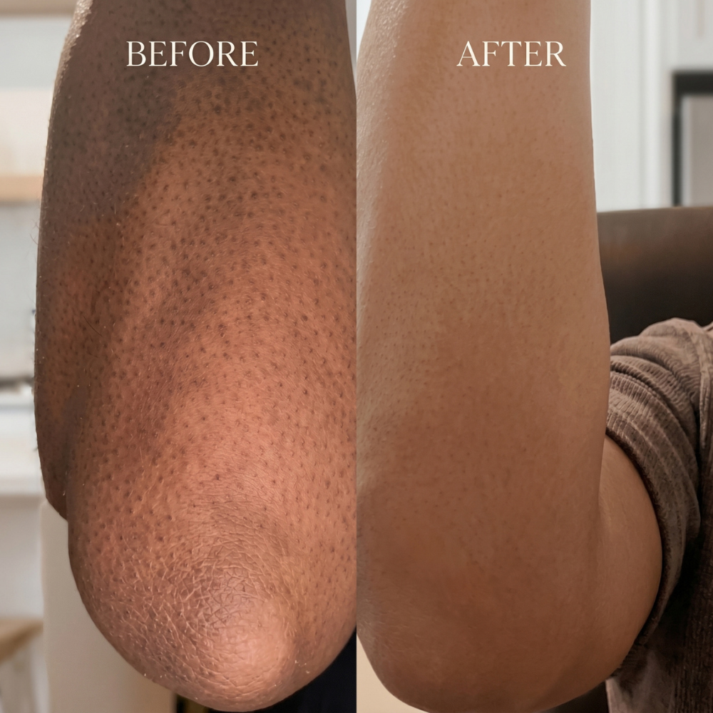Nourishing Body Butter for Sensitive Skin-2